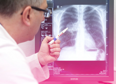 Cancerul pulmonar la copii: cum se manifesta si cum se trateaza