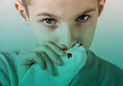 Primul ajutor în caz de sângerări nazale