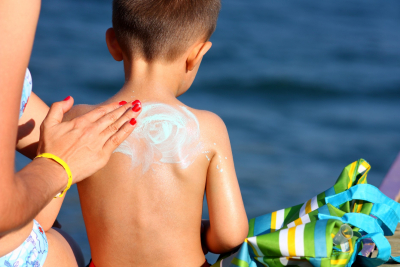 Arsurile solare la copii lasa urme pentru tot restul vietii!